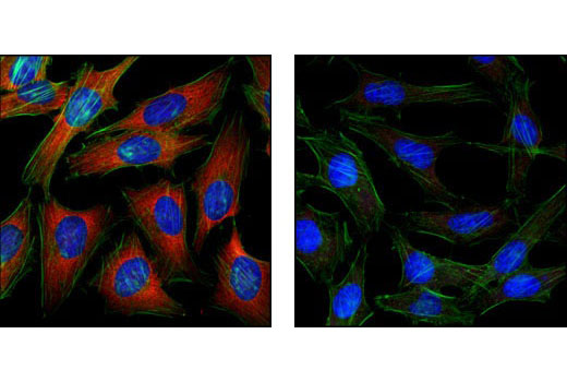 Immunofluorescence Image 2: Anti-mouse IgG (H+L), F(ab')2 Fragment (Alexa Fluor® 555 Conjugate)