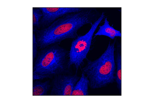 Immunofluorescence Image 2: Anti-mouse IgG (H+L), F(ab')2 Fragment (Alexa Fluor® 647 Conjugate)