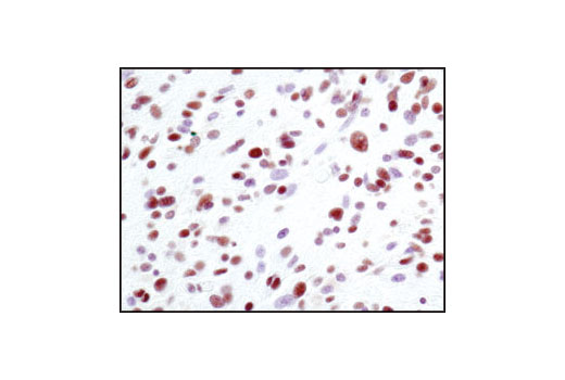 Immunohistochemistry Image 1: Ku80 (C48E7) Rabbit mAb (BSA and Azide Free)