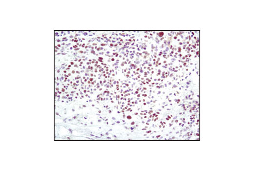 Immunohistochemistry Image 3: Ku80 (C48E7) Rabbit mAb (BSA and Azide Free)