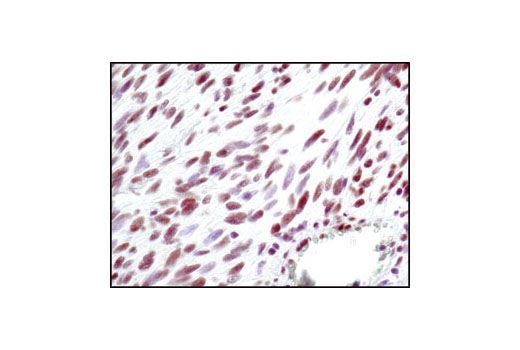 Immunohistochemistry Image 4: Ku80 (C48E7) Rabbit mAb (BSA and Azide Free)