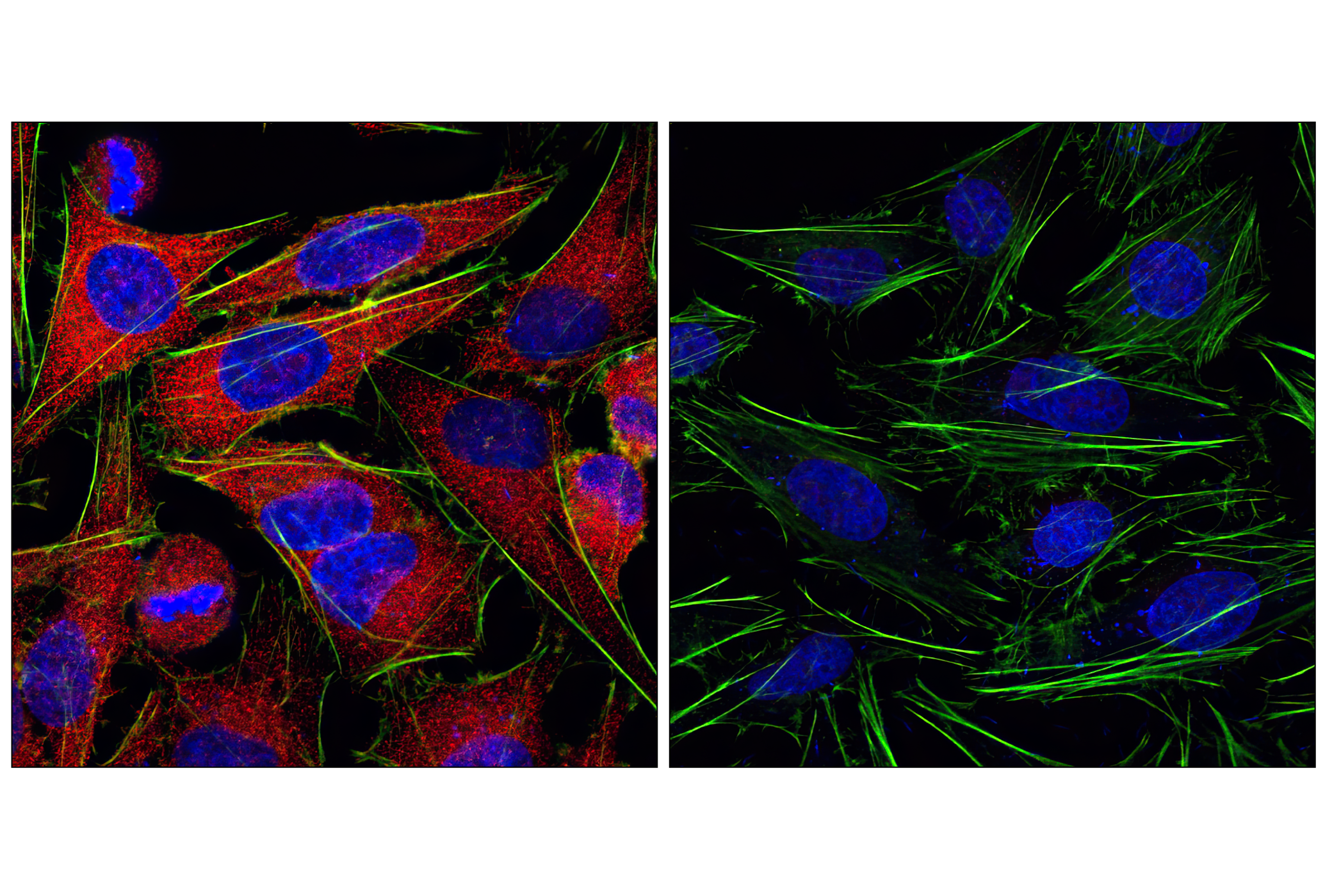 Immunofluorescence Image 2: Anti-rabbit IgG (H+L), F(ab')2 Fragment (Alexa Fluor® 555 Conjugate)