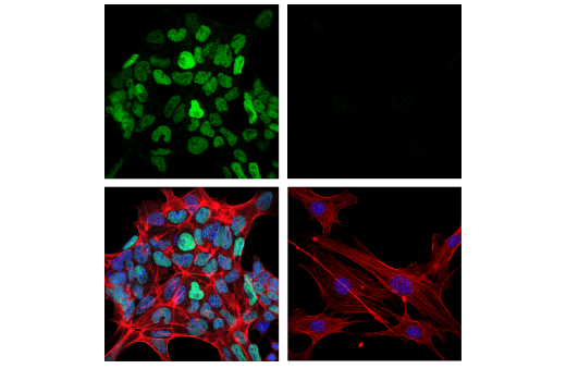 Immunofluorescence Image 1: DNMT3B (E9X7R) Rabbit mAb (Mouse Specific)