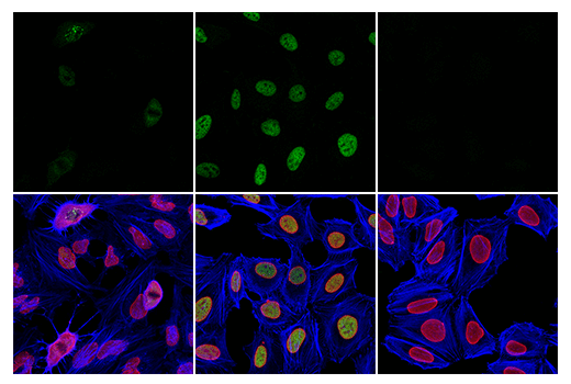 Immunofluorescence Image 1: Phospho-ATF-2 (Thr69)/ATF-7 (Thr51) (E3D6B) Rabbit mAb
