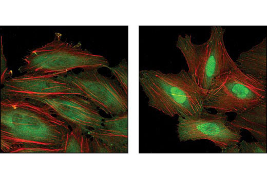 Immunofluorescence Image 2: Anti-rat IgG (H+L), (Alexa Fluor® 488 Conjugate)