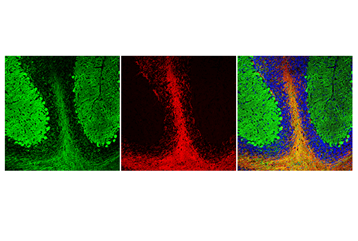 Immunofluorescence Image 1: Anti-rat IgG (H+L), (Alexa Fluor® 555 Conjugate)