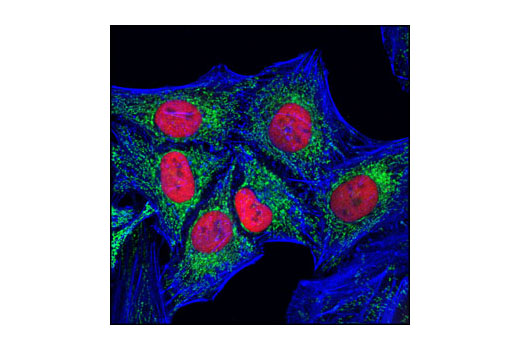 Immunofluorescence Image 2: Anti-rat IgG (H+L), (Alexa Fluor® 555 Conjugate)