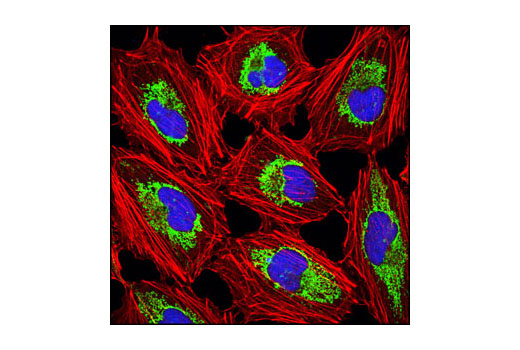 Immunofluorescence Image 2: Anti-rat IgG (H+L), (Alexa Fluor® 647 Conjugate)