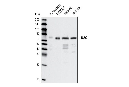 Western Blotting Image 1: NAC1 Antibody