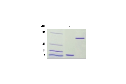  Image 1: Human IL-5 Recombinant Protein