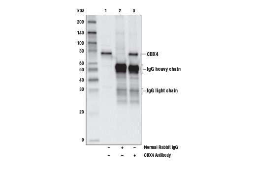 Immunoprecipitation Image 1: CBX4 Antibody