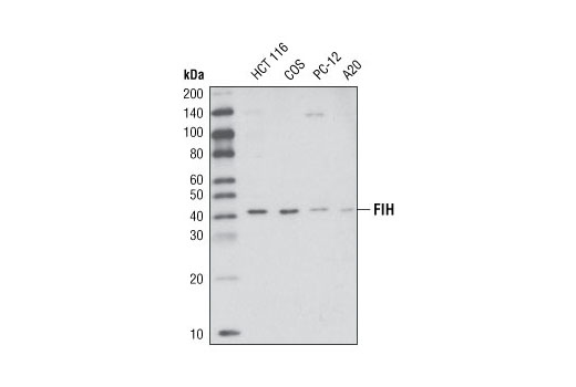  Image 3: Hypoxia Pathway Antibody Sampler Kit