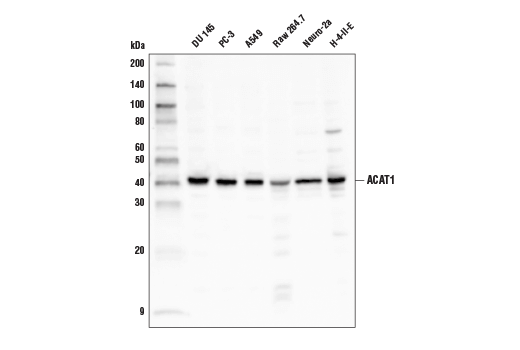 Western Blotting Image 1: ACAT1 Antibody