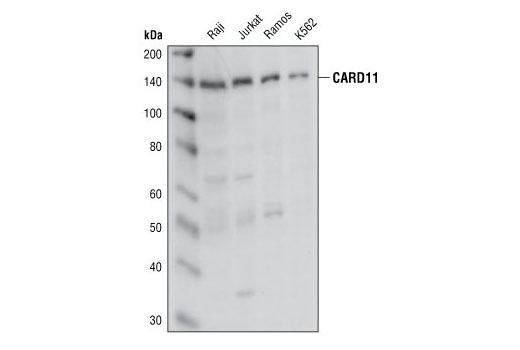 Western Blotting Image 1: CARD11 Antibody