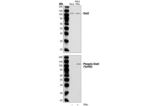  Image 3: Phospho-Stat Antibody Sampler Kit