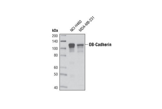 Western Blotting Image 1: OB-Cadherin (P707) Antibody