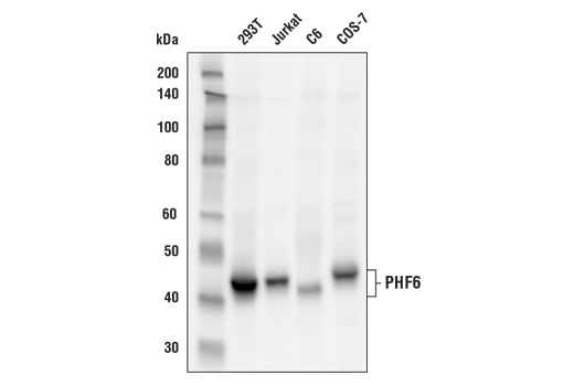 Western Blotting Image 1: PHF6 Antibody