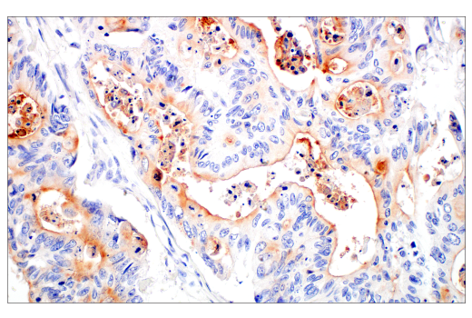 Immunohistochemistry Image 1: MUC13 (E6Z1K) Rabbit mAb