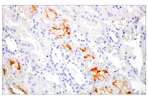 Immunohistochemistry Image 3: MUC13 (E6Z1K) Rabbit mAb