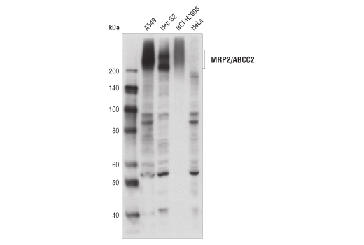 Western Blotting Image 1: MRP2/ABCC2 (R260) Antibody
