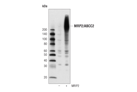 Western Blotting Image 2: MRP2/ABCC2 (R260) Antibody