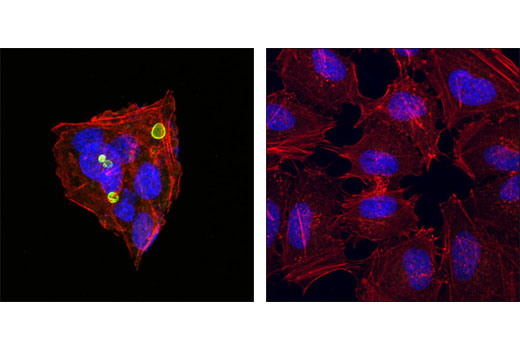 Immunofluorescence Image 1: MRP2/ABCC2 (R260) Antibody