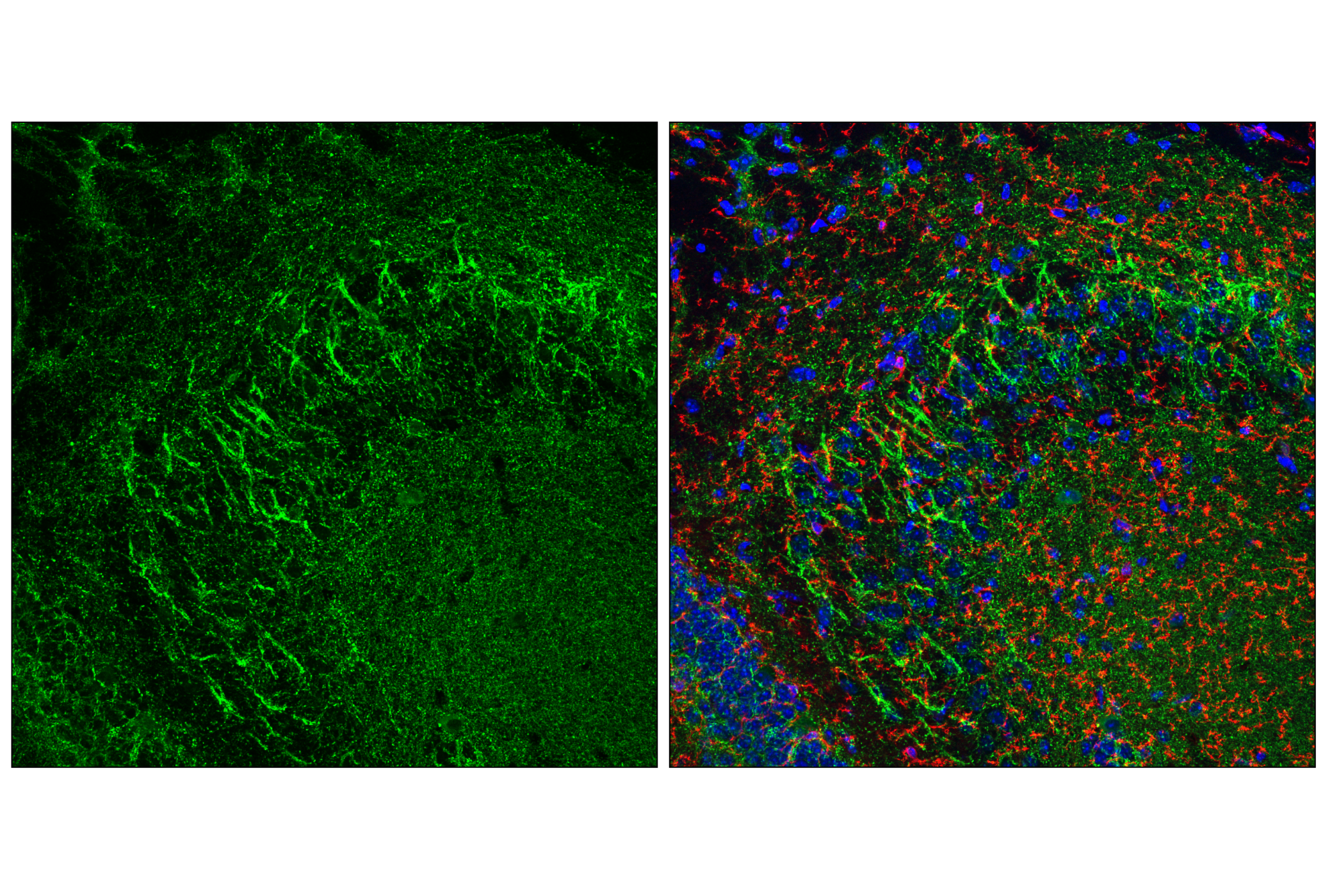 Immunofluorescence Image 1: VGAT Antibody