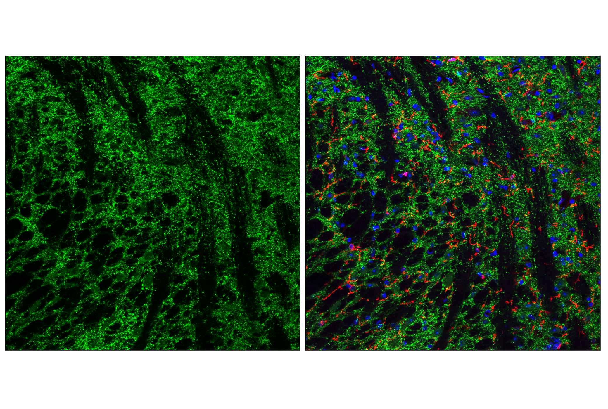 Immunofluorescence Image 4: VGAT Antibody