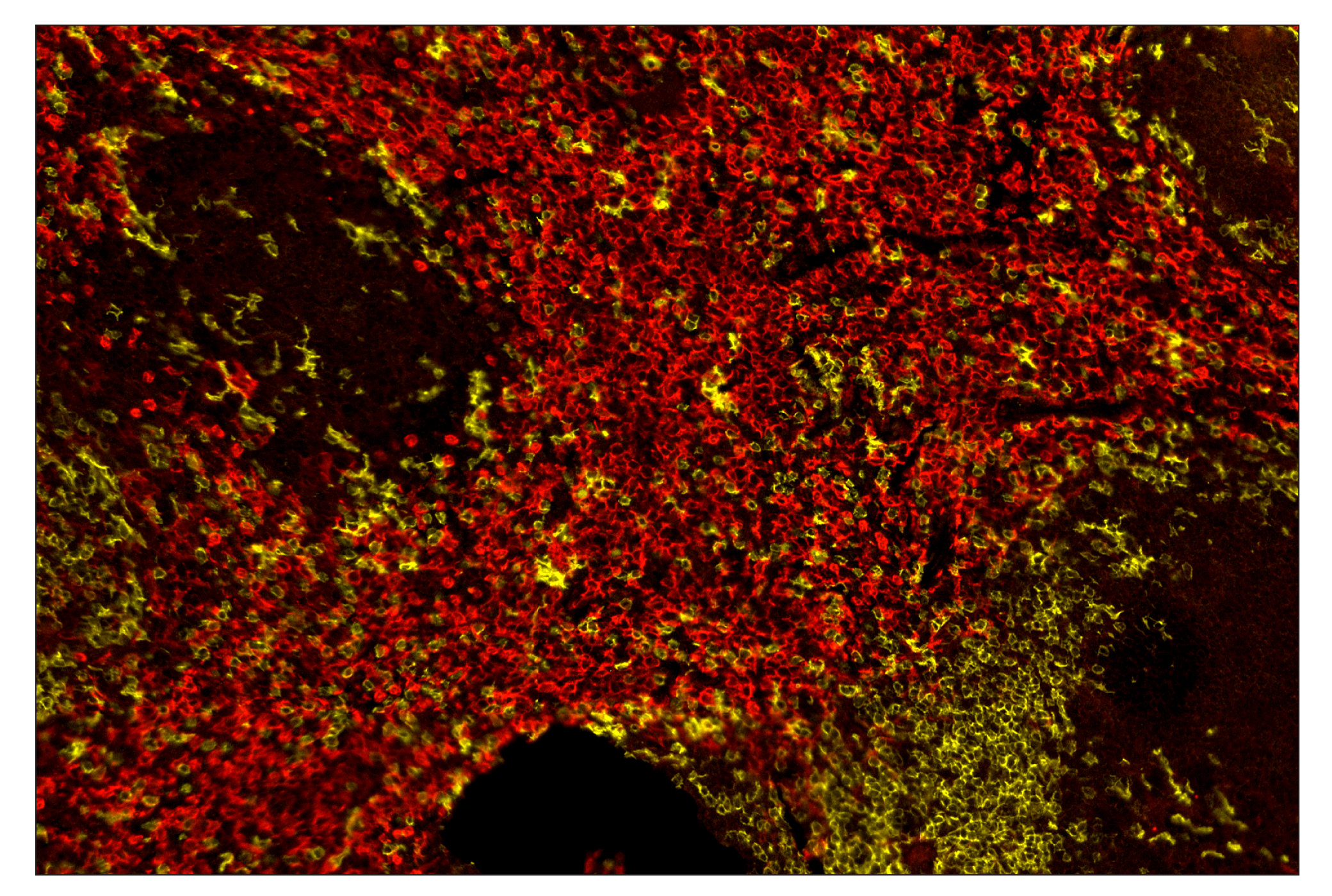 Immunohistochemistry Image 7: CD8α (D4W2Z) & CO-0040-488 SignalStar™ Oligo-Antibody Pair