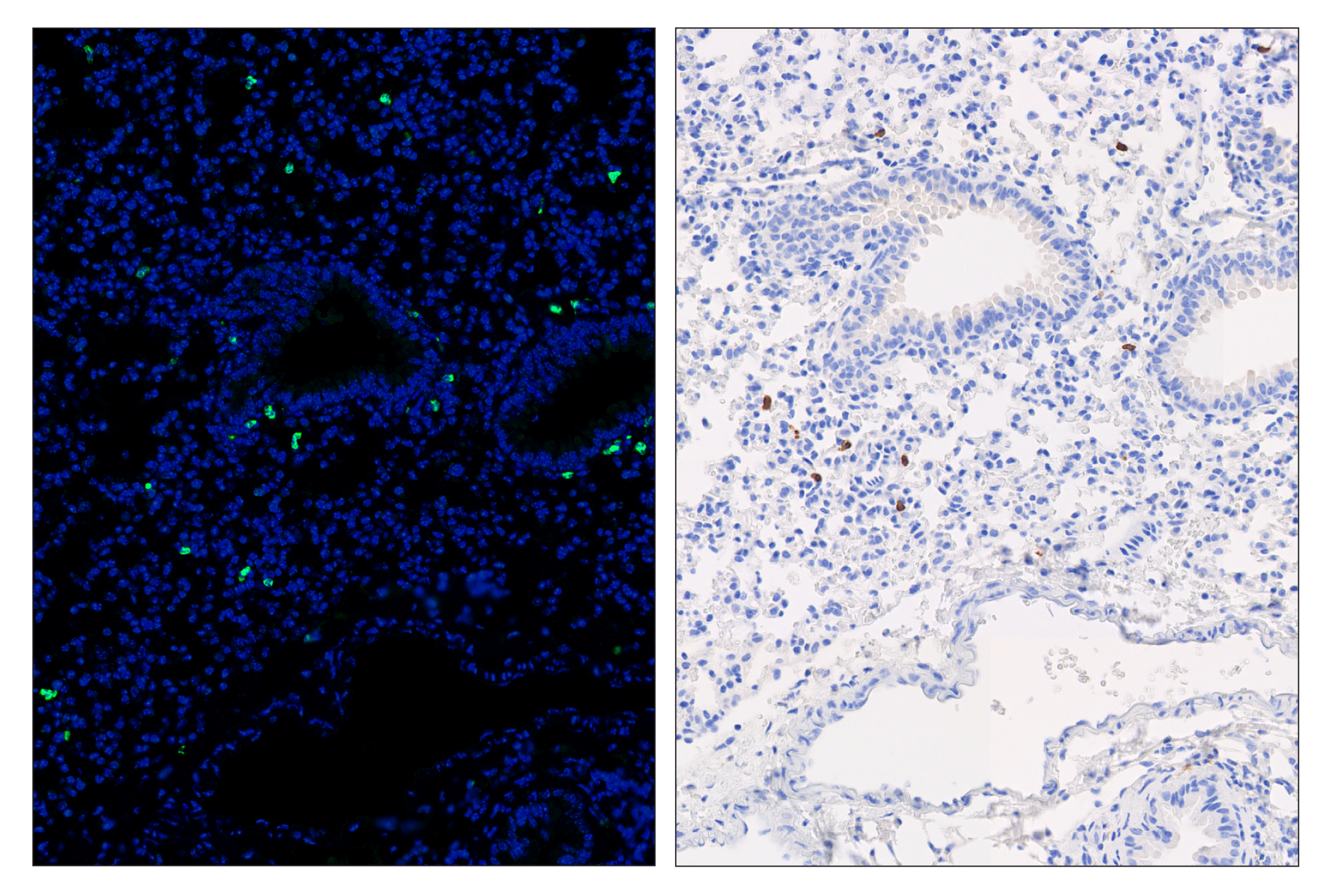 Immunohistochemistry Image 6: CD8α (D4W2Z) & CO-0040-750 SignalStar™ Oligo-Antibody Pair