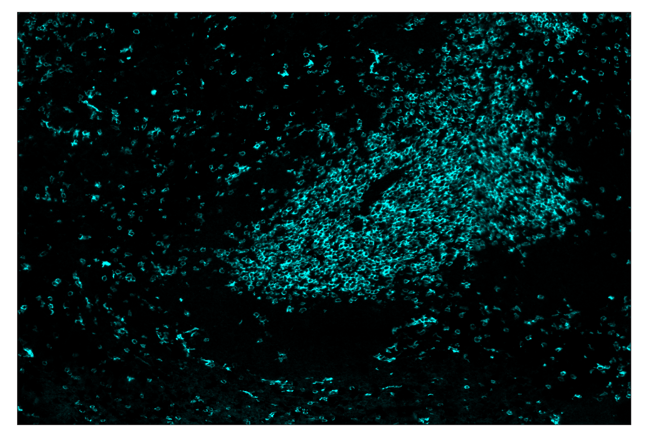 Immunohistochemistry Image 5: CD8α (D4W2Z) & CO-0040-750 SignalStar™ Oligo-Antibody Pair