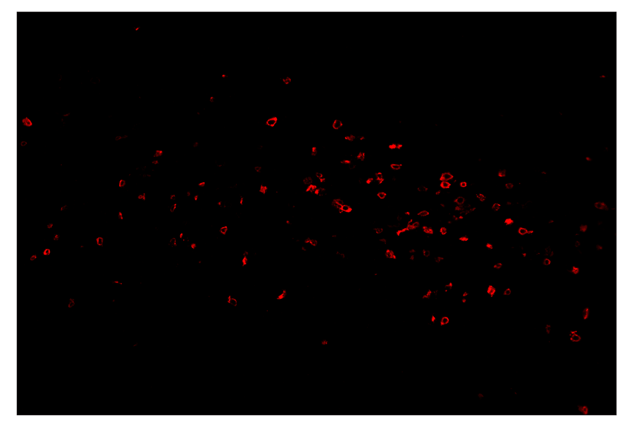 Immunohistochemistry Image 4: CD8α (D4W2Z) & CO-0040-647 SignalStar™ Oligo-Antibody Pair