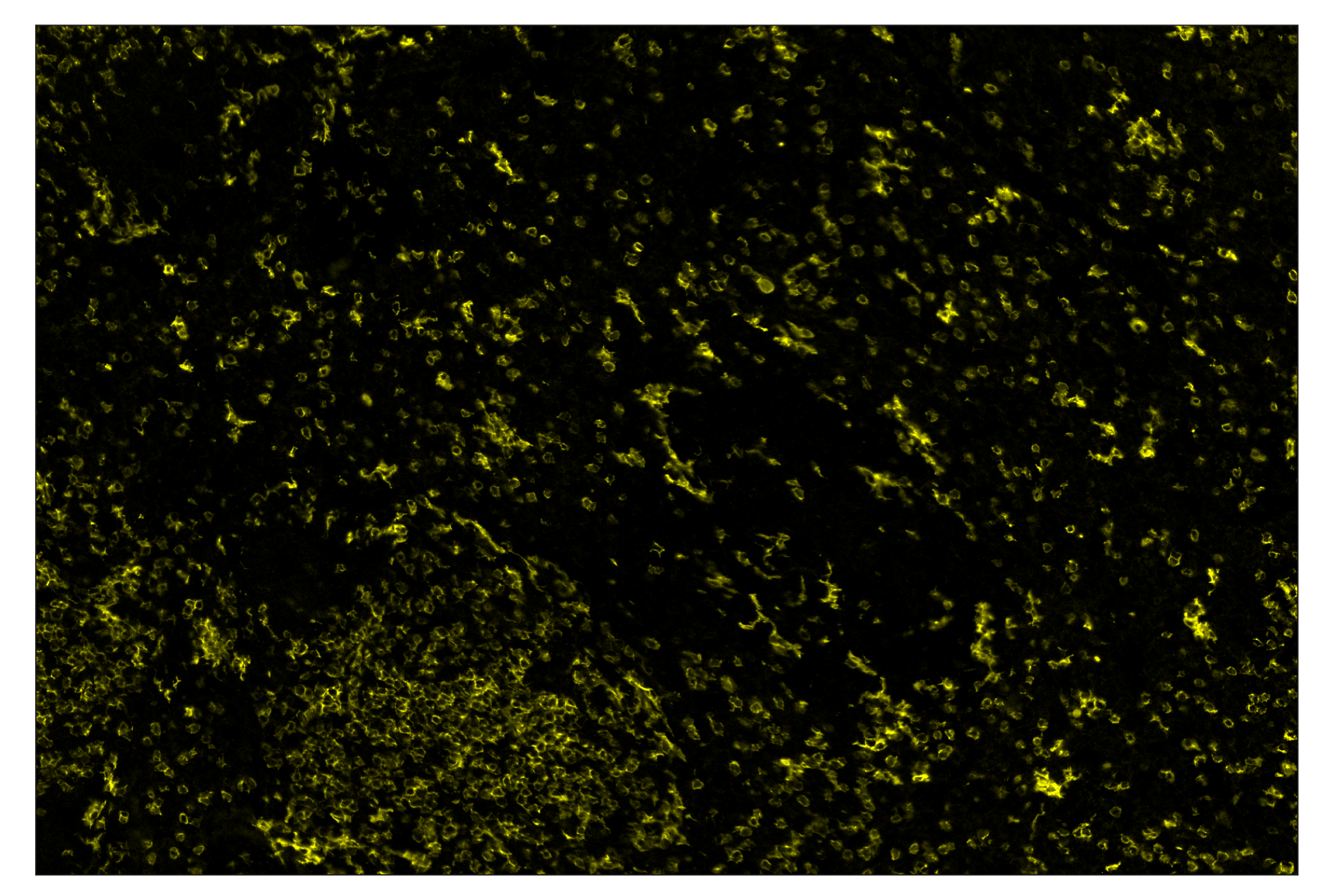 Immunohistochemistry Image 3: CD8α (D4W2Z) & CO-0040-750 SignalStar™ Oligo-Antibody Pair