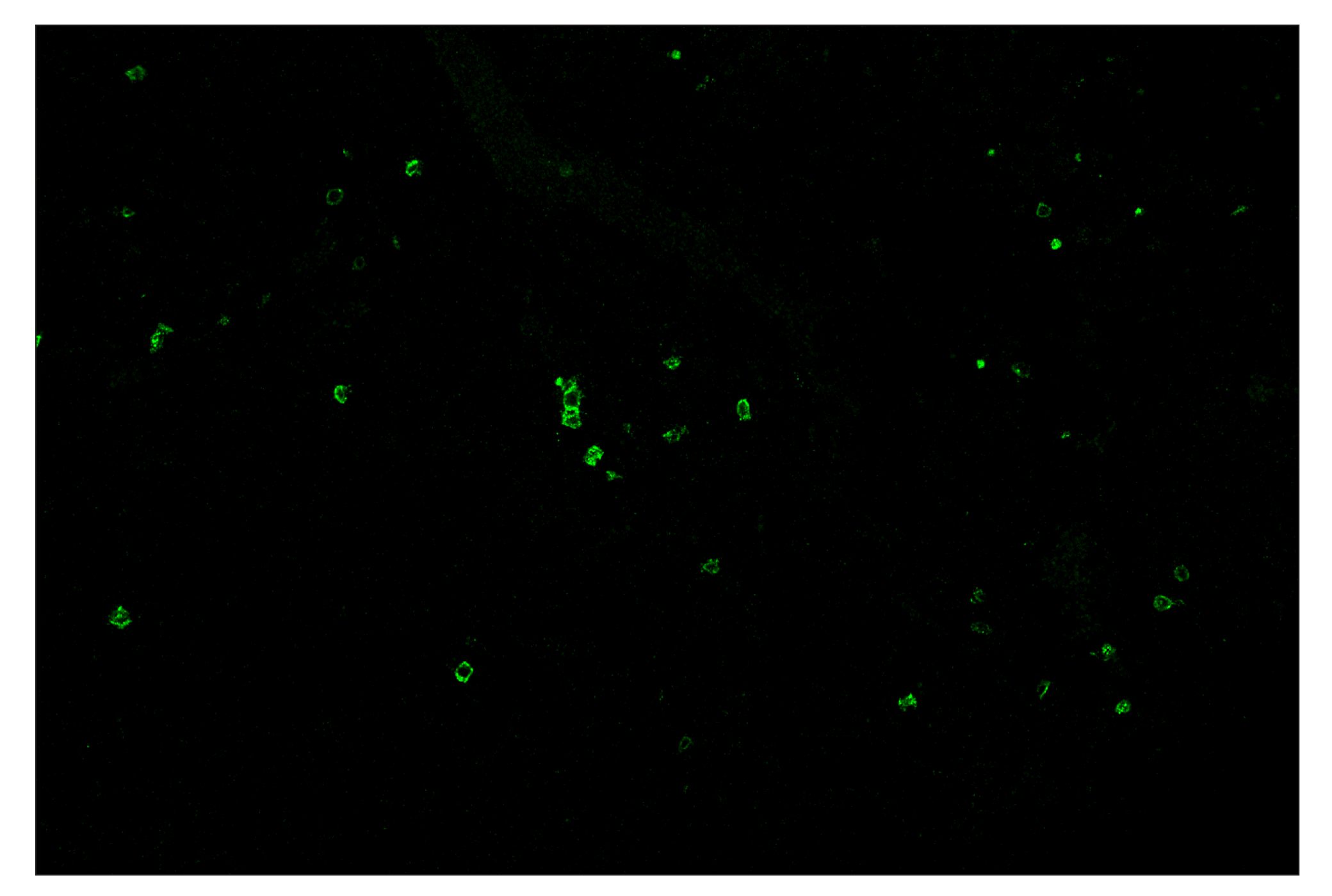 Immunohistochemistry Image 2: CD8α (D4W2Z) & CO-0040-750 SignalStar™ Oligo-Antibody Pair