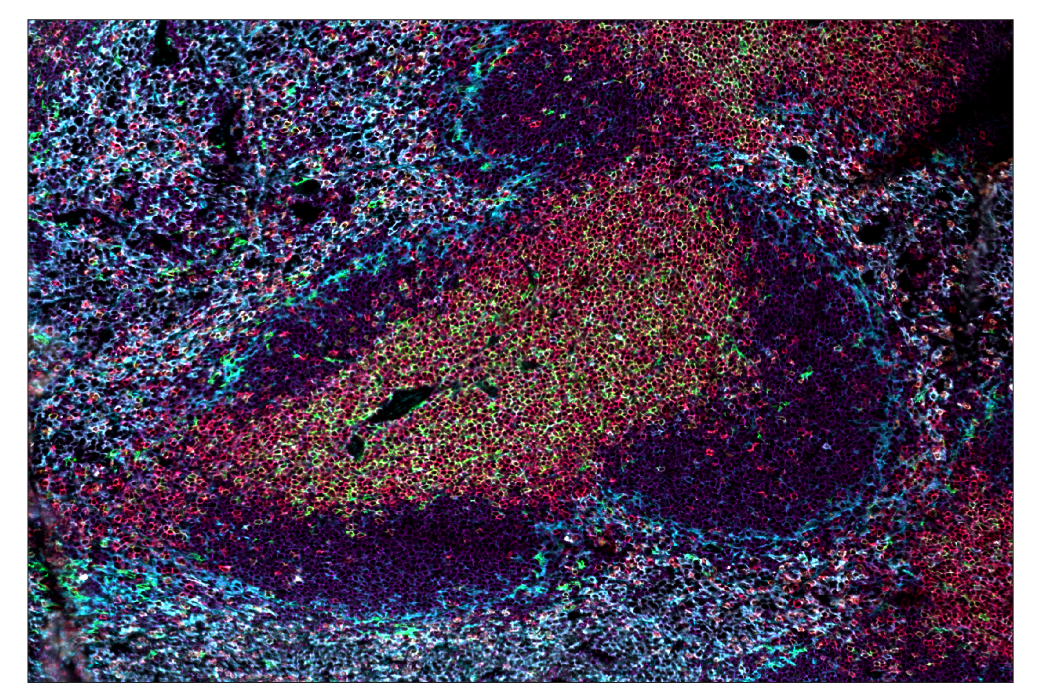 Immunohistochemistry Image 1: CD8α (D4W2Z) & CO-0040-750 SignalStar™ Oligo-Antibody Pair