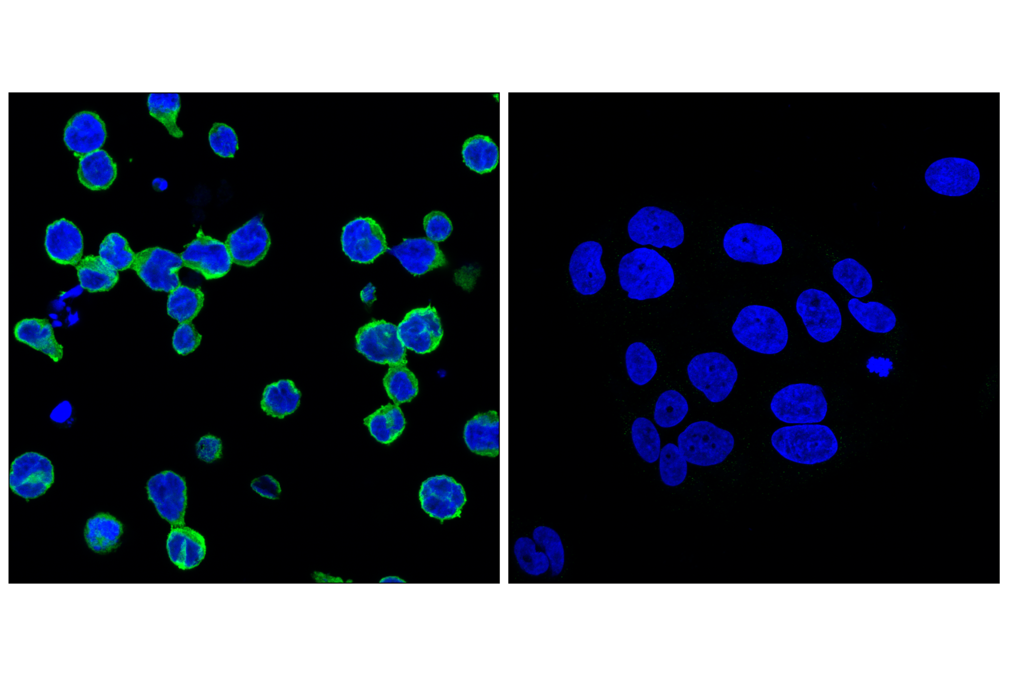 Immunofluorescence Image 1: SHIP1 (C40G9) Rabbit mAb (BSA and Azide Free)