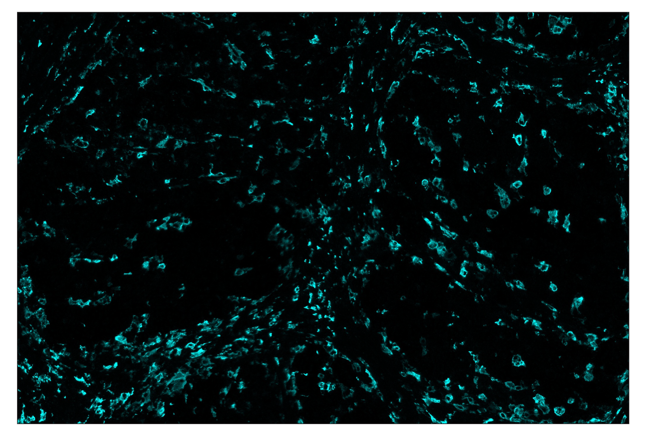 Immunohistochemistry Image 5: CD163 (D6U1J) & CO-0022-488 SignalStar™ Oligo-Antibody Pair