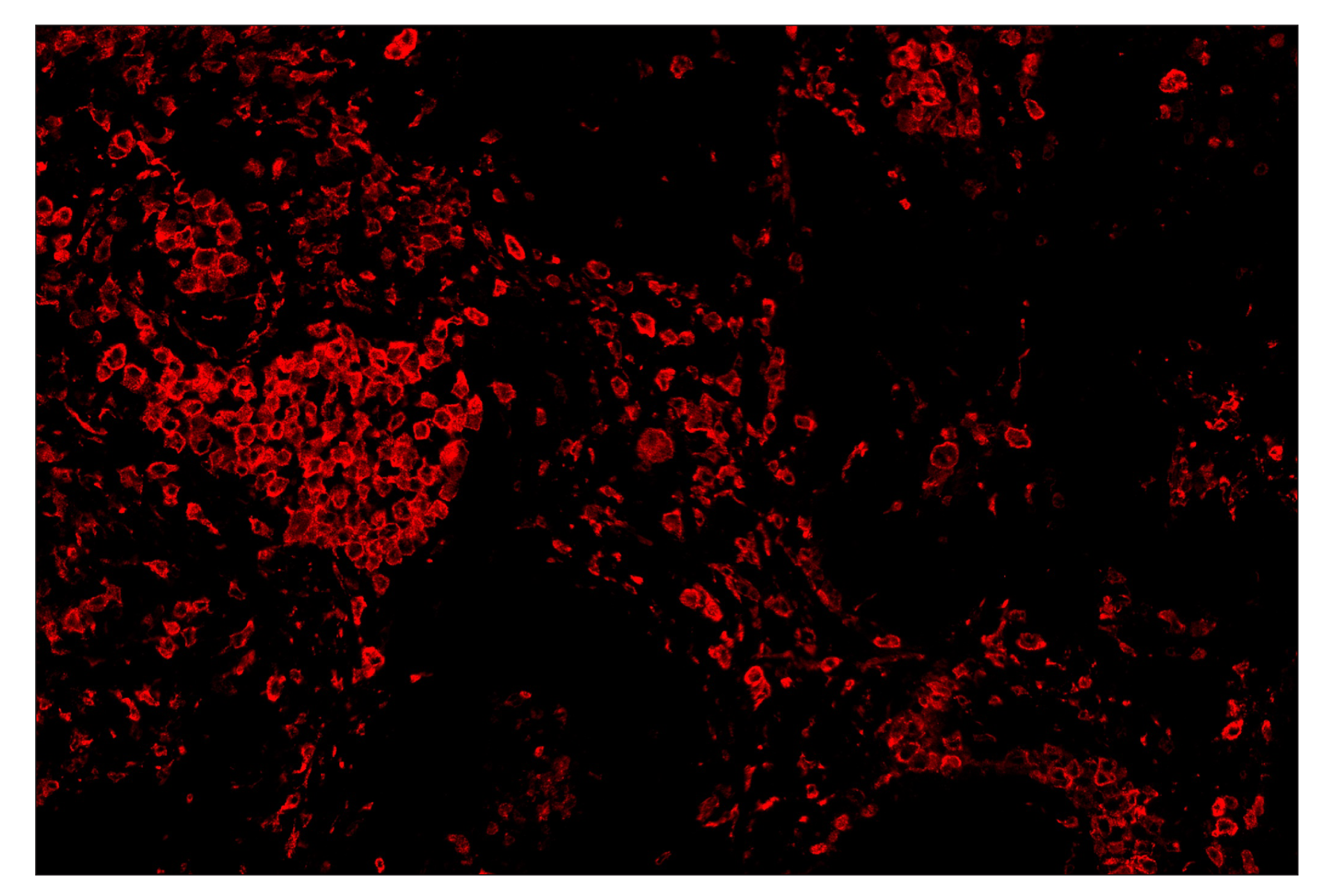 Immunohistochemistry Image 4: CD163 (D6U1J) & CO-0022-647 SignalStar™ Oligo-Antibody Pair