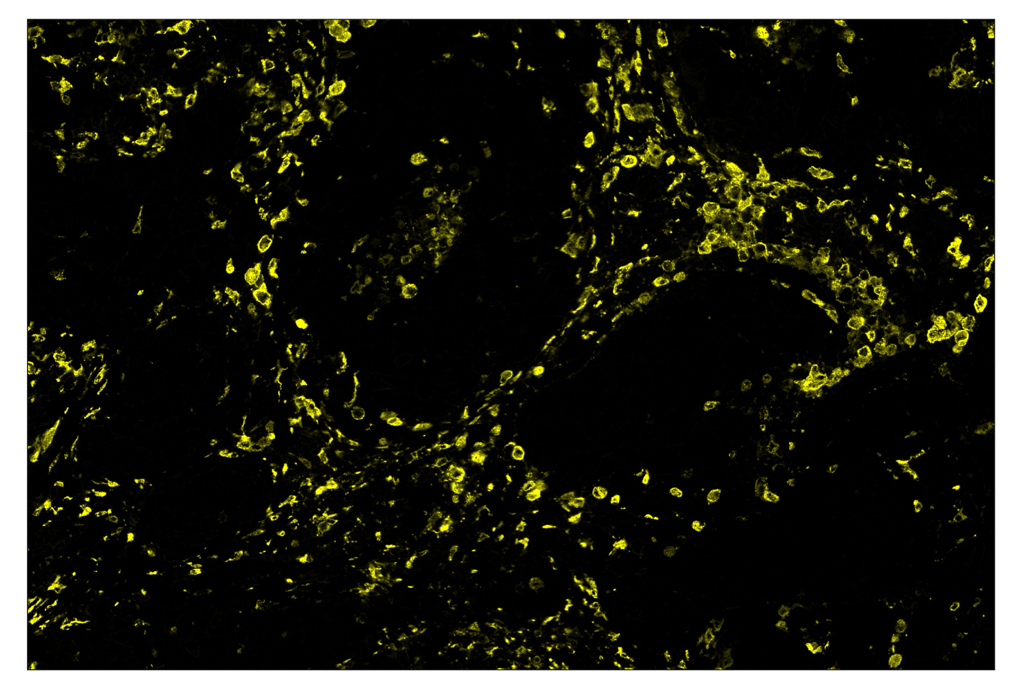 Immunohistochemistry Image 3: CD163 (D6U1J) & CO-0022-750 SignalStar™ Oligo-Antibody Pair