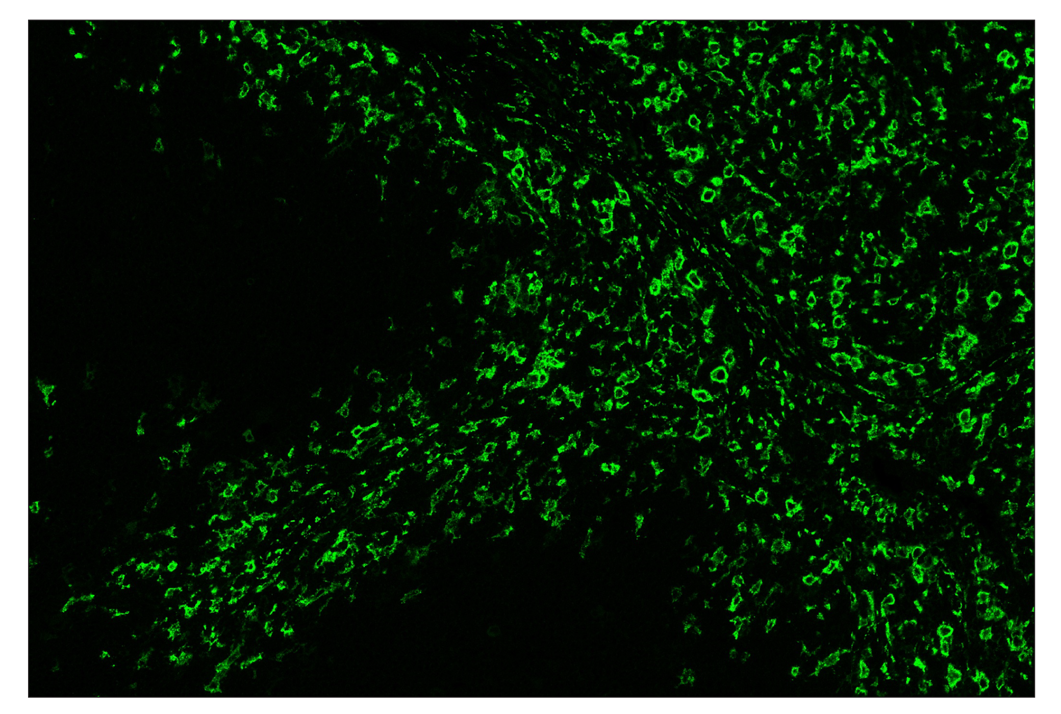 Immunohistochemistry Image 2: CD163 (D6U1J) & CO-0022-594 SignalStar™ Oligo-Antibody Pair