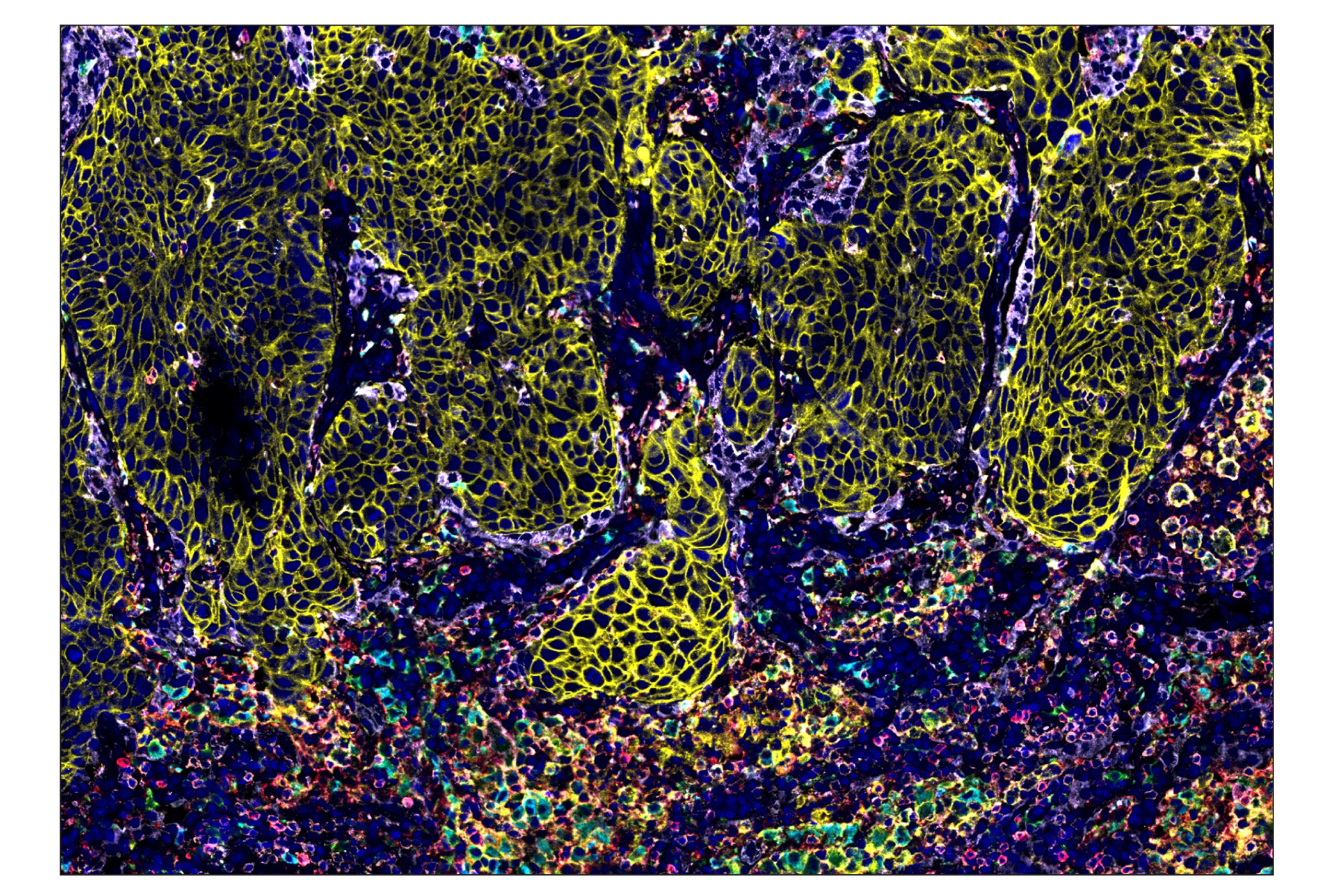 Immunohistochemistry Image 1: CD163 (D6U1J) & CO-0022-488 SignalStar™ Oligo-Antibody Pair