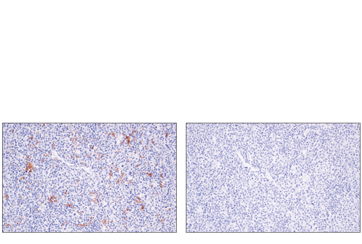 Immunohistochemistry Image 6: XCR1 (D2F8T) Rabbit mAb