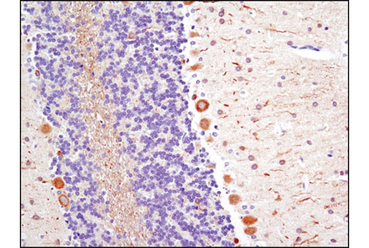 Beta 3 Tubulin Antibody (TU-20) | Cell Signaling Technology