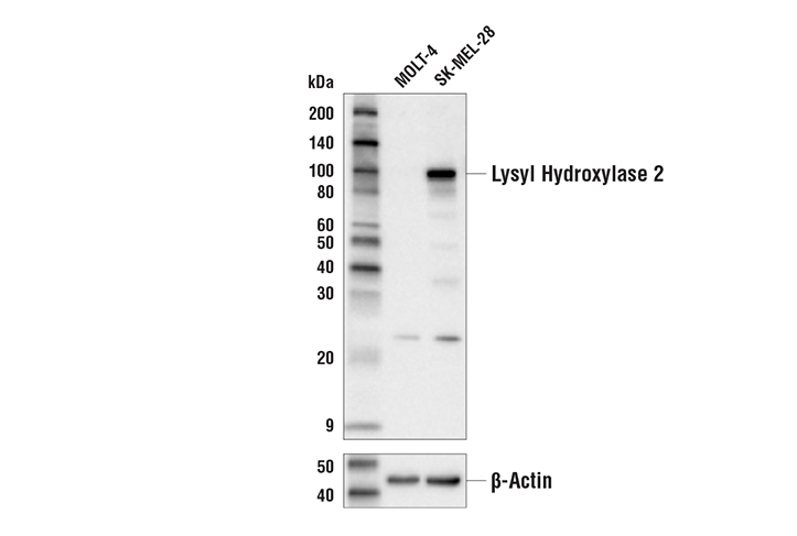 Western Blotting Image 1: Lysyl Hydroxylase 2 Antibody