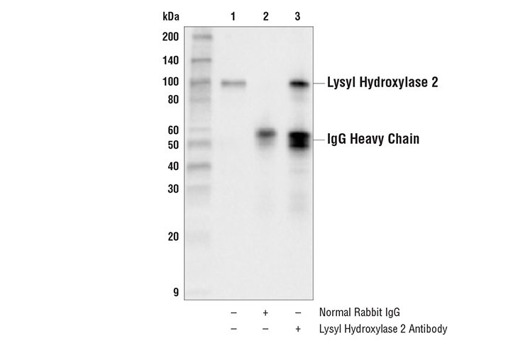 Immunoprecipitation Image 1: Lysyl Hydroxylase 2 Antibody