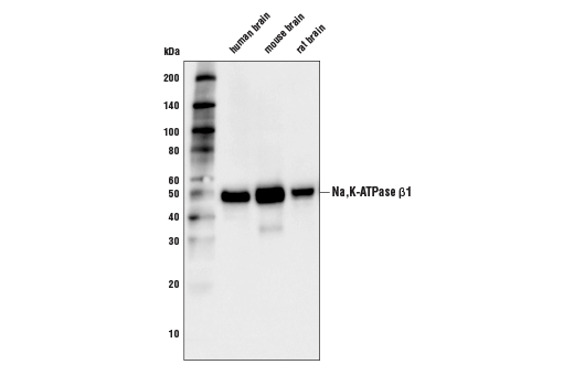 Western Blotting Image 1: Na,K-ATPase β1 (D6U8Q) Rabbit mAb