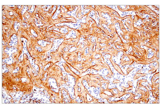 Immunohistochemistry Image 5: Fibronectin/FN1 (E5H6X) Rabbit mAb (BSA and Azide Free)