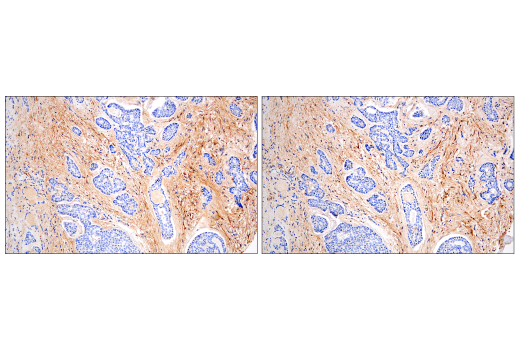 Immunohistochemistry Image 6: Fibronectin/FN1 (E5H6X) Rabbit mAb (BSA and Azide Free)