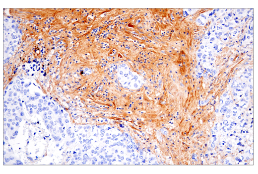 Immunohistochemistry Image 7: Fibronectin/FN1 (E5H6X) Rabbit mAb (BSA and Azide Free)