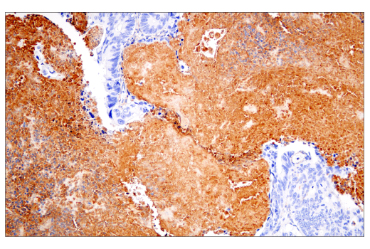 Immunohistochemistry Image 4: Fibronectin/FN1 (E5H6X) Rabbit mAb (BSA and Azide Free)